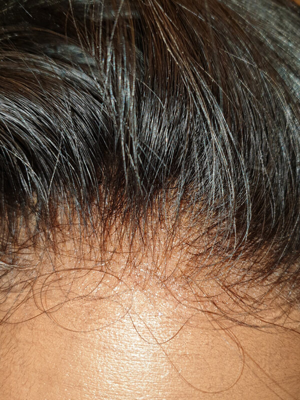 Deepwave HD Frontal - Image 5